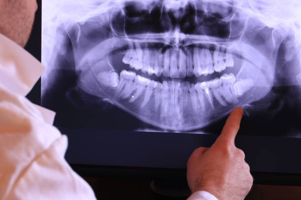 Best Weekend Emergency Dentist in San Saba, TX