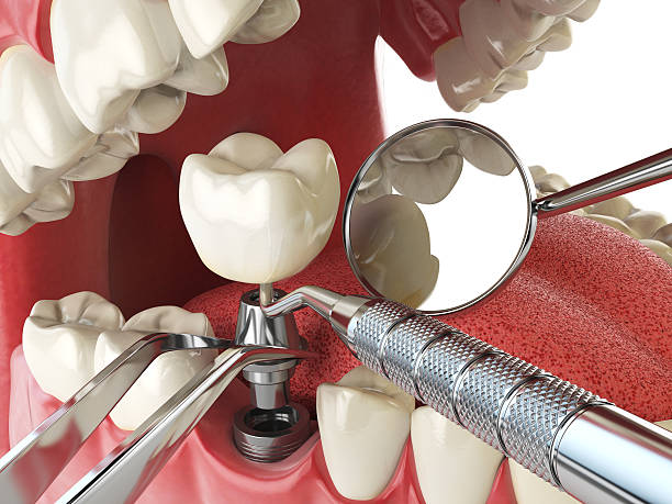 Best Emergency Dentist for Special Needs Patients in San Saba, TX